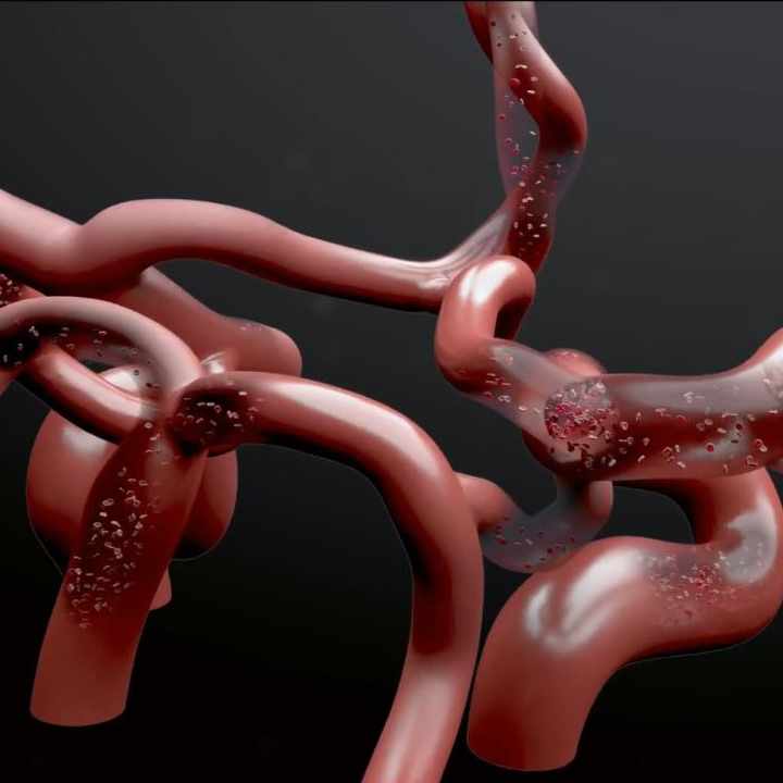 Bloodflow visualization in the circle of willis